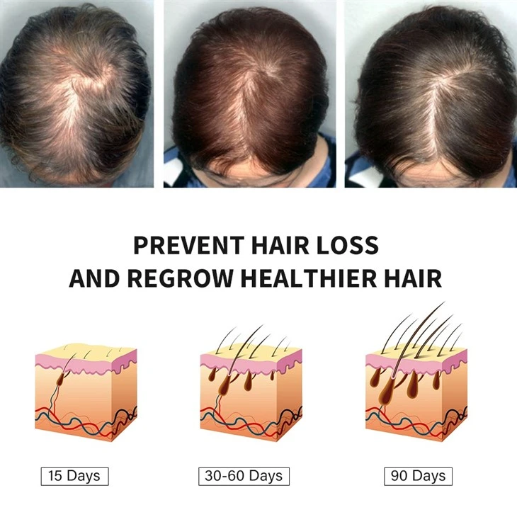 MOOYAM Rosemary Mint Scalp & Hair Strengthening Oil